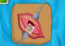 Operate Now Apendix Surgery Game